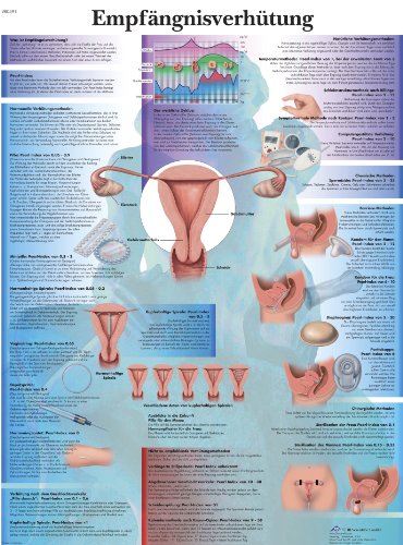 Ya en mundofriki.es: 3B Scientific VR0591UU - Póster explicativo sobre métodos anticonceptivos (en alemán)
