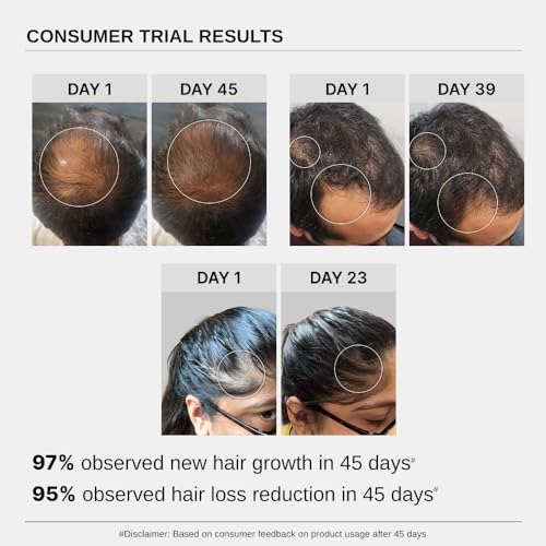 Image of Bare Anatomy Expert Anti-Hair Fall Shampoo with Peptides (250ml), Anti-Hair Fall Conditioner with Rosemary (175ml) & Advanced Hair Growth Serum with Redensyl (30ml) Hair Fall Control For Men & Women