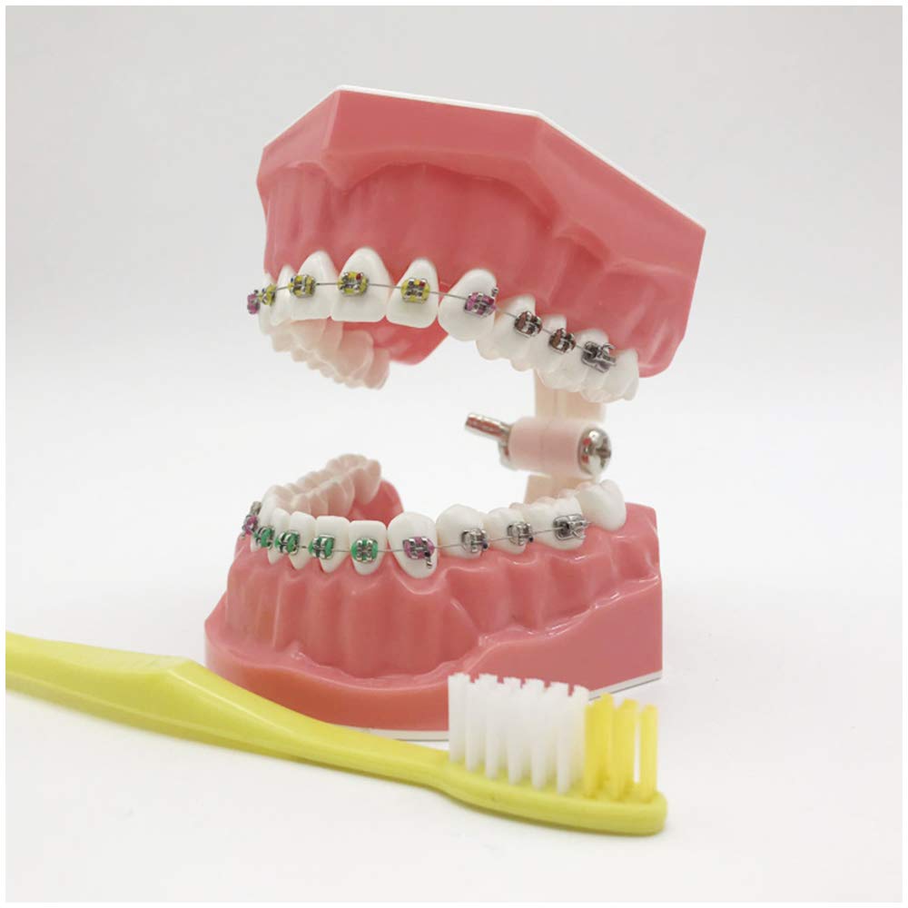 Modello Di Denti Per La Formazione - Modello Ortodontico - Modello Di Insegnamento Dei Denti Con Staffa In Metallo E Ceramica - Modello Di Formazione Correttiva Dei Denti Per L'insegnamento Dell'igien