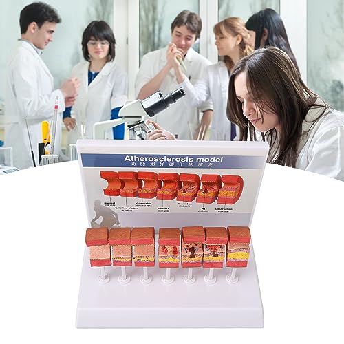 Image of 7PCS Artery Anatomy Model with Atherosclerosis Thrombus Vascular Model for Doctors, Educational Tool