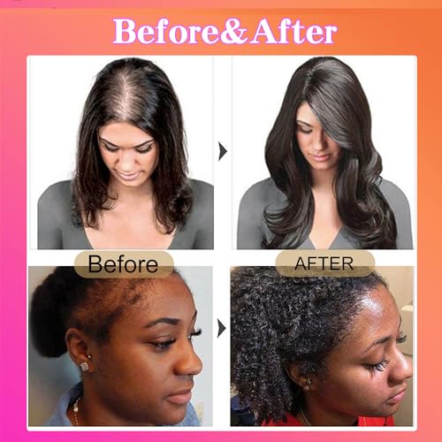 Raw Batana Oil | Batana Oil for Hair Growth | with Vitamin E |Batana Oil Conditioner | Helps Hair Eliminates Split Ends for Men and Women