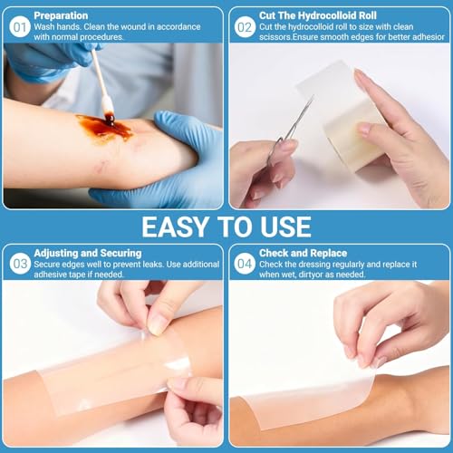 Image of Hydrocolloid Roll, Hydrocolloid Bandage for Skin Protection, Ideal for Daily Skincare and Wound Care Management, Water-Resistant Adhesive Bandage for Skin Types, 5cm*1.5M