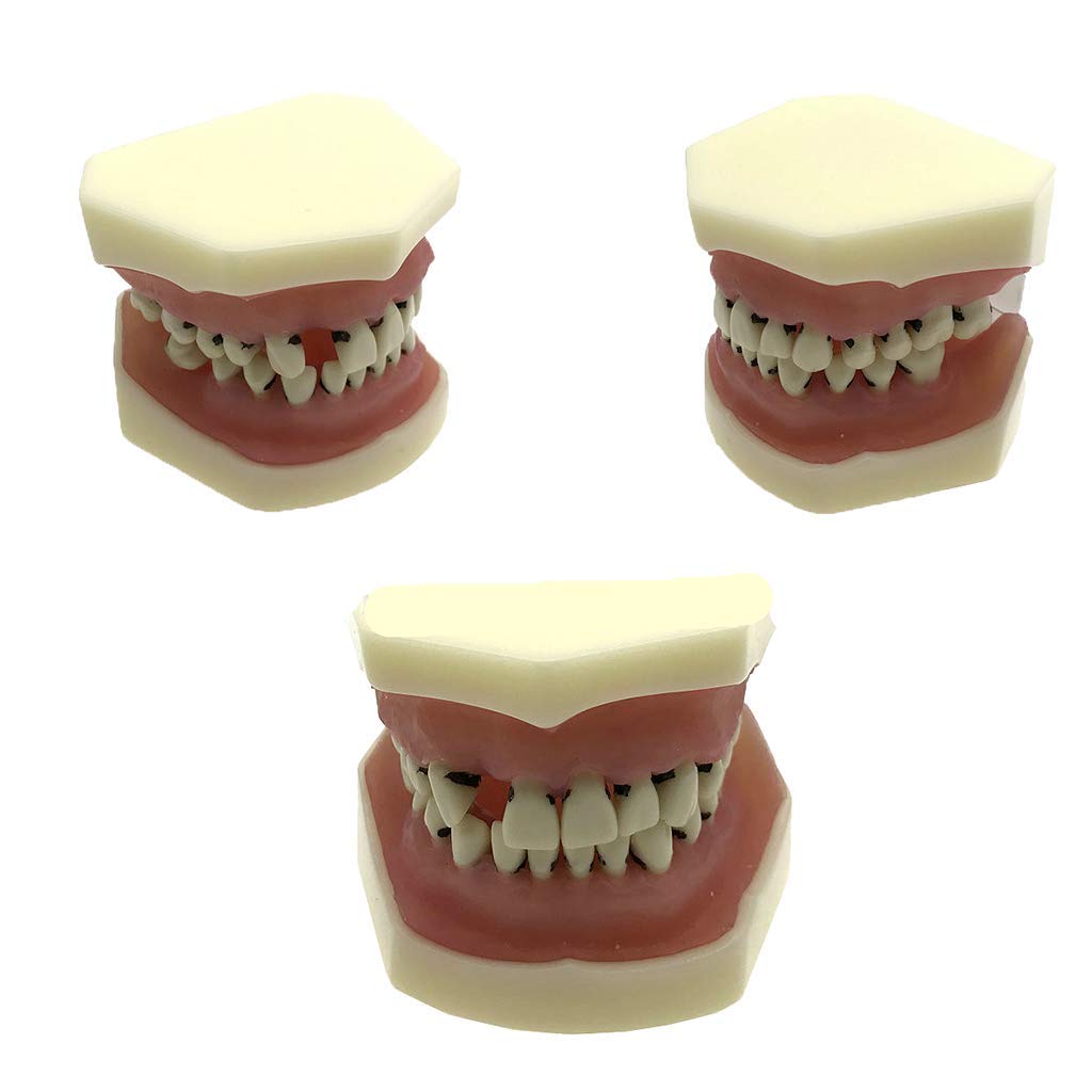 Modello Didattico di Denti Standard Ortodontici per Studenti di Odontoiatria Infantile, Modello Anatomico Dentale, Modello Dimostrativo Dentale