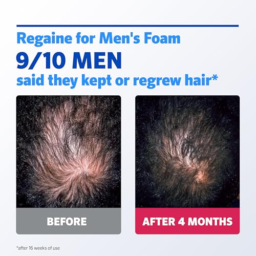Regaine For Men Extra Strength Foam - Scientifically Proven To Help Stop Hereditary Hair Loss - Minoxidil Foam for Hair Regrowth - (3 x 73ml), Packaging May Vary - Image 5