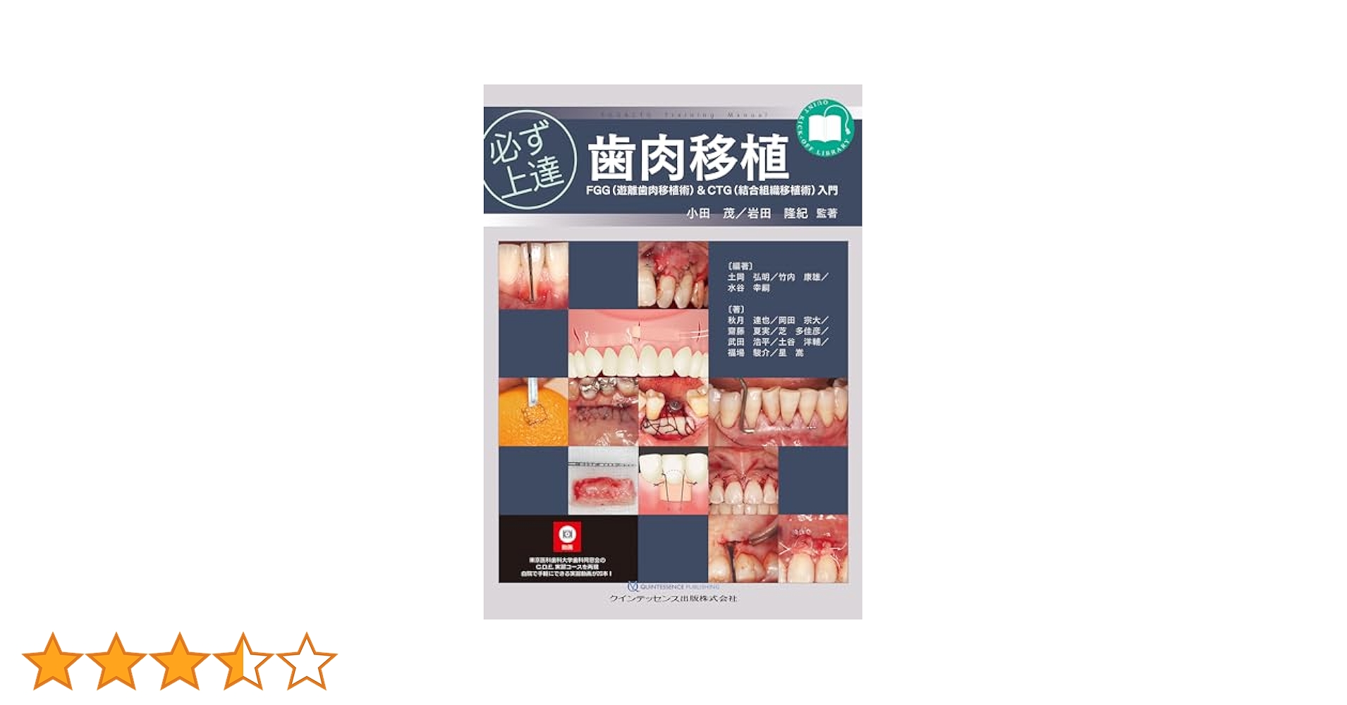必ず上達 歯肉移植 FGG(遊離歯肉移植術)&CTG(結合組織移植術)入門 必ず上達 歯肉移植: FGG(遊離歯肉移植術)&CTG(結合組織移植術