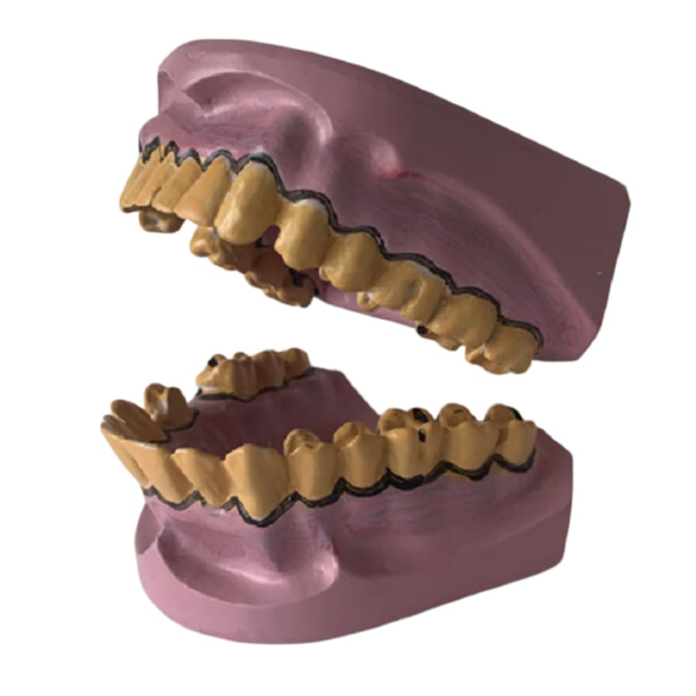 YRQMGSF Cavity and Yellowed Teeth Model - Pathological Tooth Model - Smoking Hazards Dental Model for Demonstration Teaching, Lab Supplies