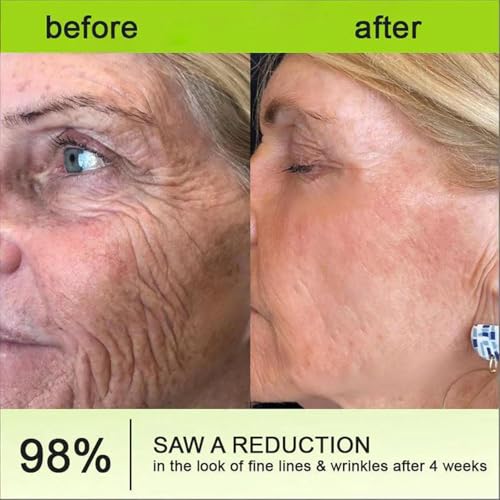 Generic Celestvera Botoxmix Cream,Anti-Wrinkle Cream,Wrinkle Anti New Pore Minimizer Cream, Lift Tightening Retinol Booster, Retinal Serum, Advanced Body Lotion Bottle 1PCS