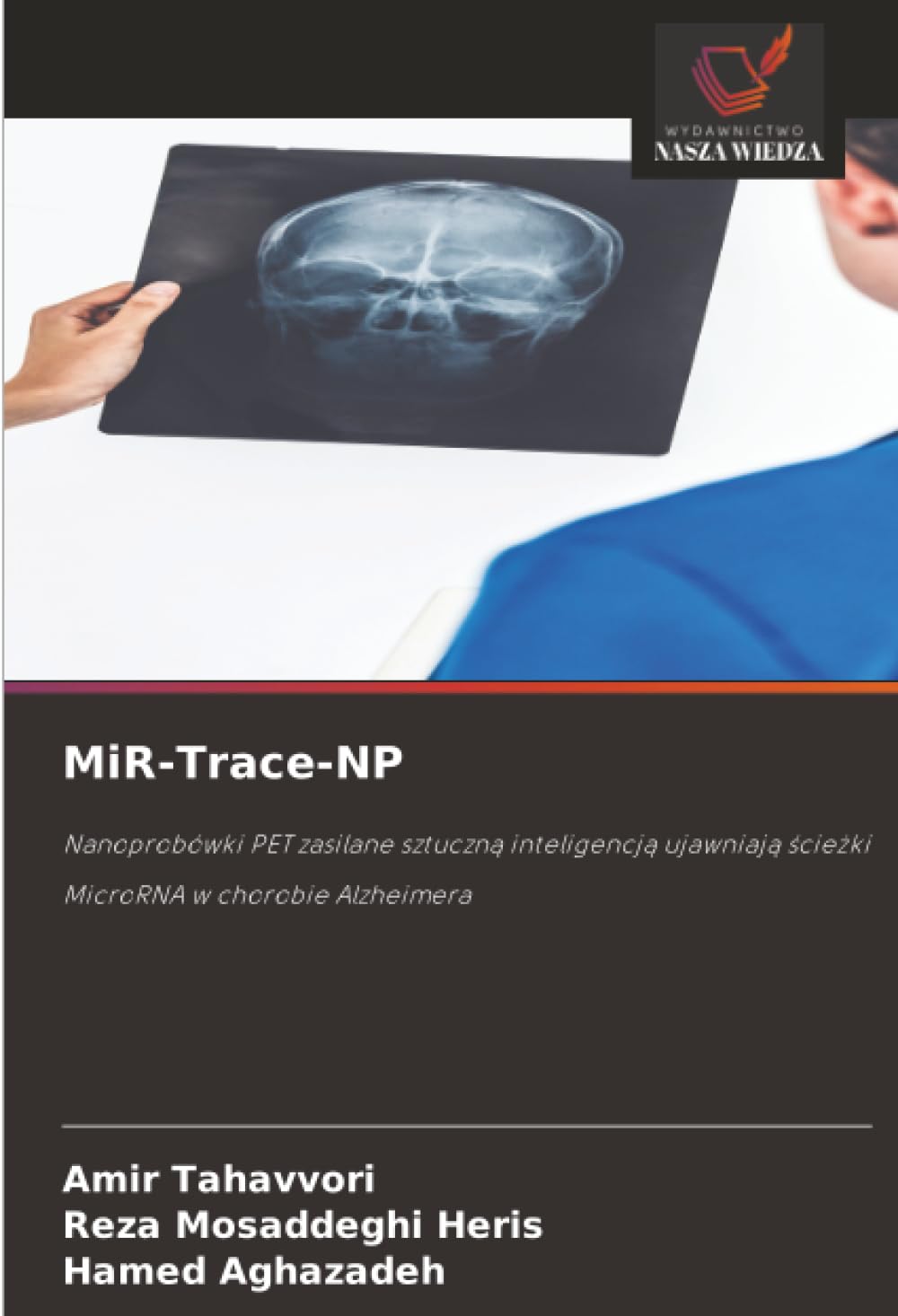 MiR-Trace-NP: Nanoprobówki PET zasilane sztuczn¿ inteligencj¿ ujawniaj¿ ¿cie¿ki MicroRNA w chorobie Alzheimera