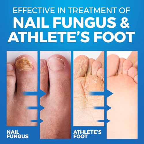 View 4