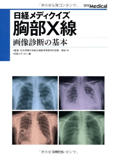 日経メディクイズ 胸部X線 画像診断の基本 | 徳田均, 日経