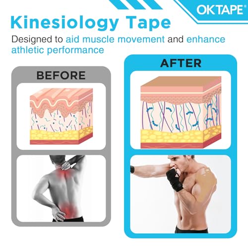 Image of OK TAPE 100Pcs Precut Kinesiology Tape Strips, Elastic Athletic Tape | for Joints Support & Muscle Pain Relief, Waterproof, Kinetic Tape for Shoulder, Knee, Ankle (Beige, 2 inch x 10 inch)