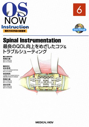 Spinal Instrumentation?最良のQOL向上をめざしたコツ&トラブルシューティング [DVD付] (OS NOW Instruction) 久敏， 馬場 Amazon.co.jp: Spinal Instrumentation−最良のQOL向上をめざし