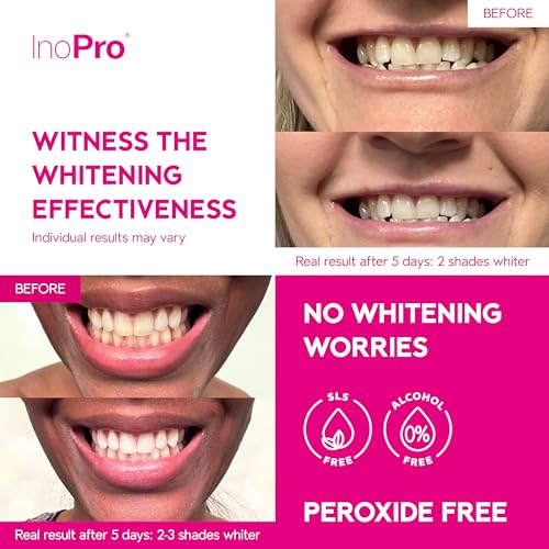 Image of InoPro Teeth Whitening Strips 21 Treatments Kit - Teeth Whitener, Peroxide Free, Green White Strips for Teeth Whitening with Arbutin, Coconut Oil, Deep Stains Removal (42 Strips)