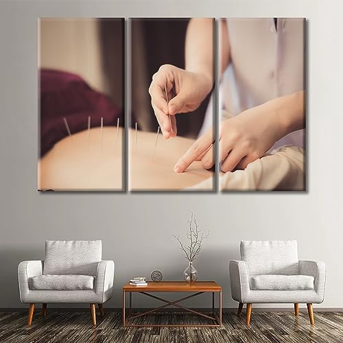 Image of TUMOVO 3 Panels Acupuncture and Moxibustion Large Wall Art Traditional Chinese Medicine Wall Art for Living Room Traditional Art Prints Giclee Print Stretched and Framed Ready to Hang (60 inch Wx40 H)