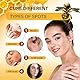 2pc Warzenentfernungscreme, Bienengiftsalbe, Geeignet zur Warzenentfernung, Warzen Creme und Etikettenentferner, Entfernung Von Dornwarzen Am Fuß & Hand, Hautmarkenentfernung, sicher und sanft