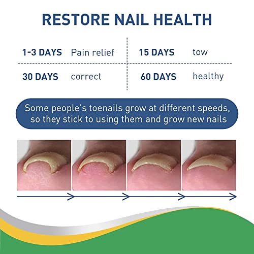 Treatment Ingrown Toenail Corrector Strips,Fitmedify Nail Patches with Nail Correction Tool Kit,Toenail Correction Patch,Ingrown Toenail Removal Kit - Image 8