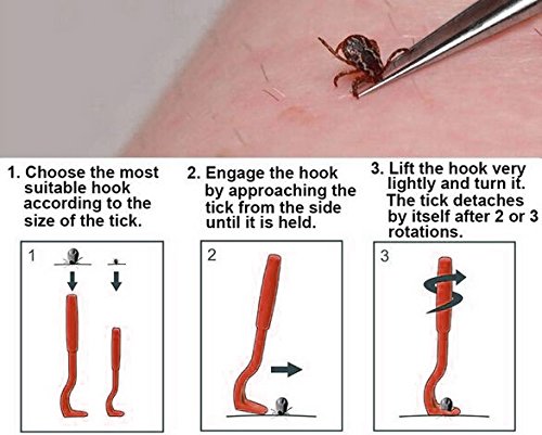 Anti Tick/Lice/Flea/Mite Remover/Picker/Tweezer for Healthy Care of Puppies/Dog/Cat/Kitten (Red) 1