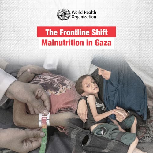 Malnutrition in Gaza