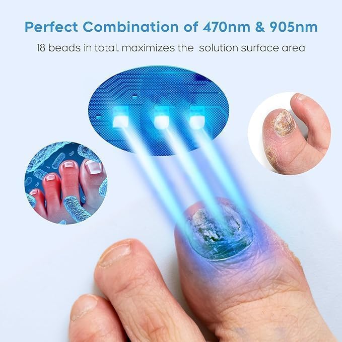 ZZP Nail Fungus Light Device and its USB charging cable laid out on a surface.