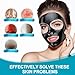 Blackhead Remover Mask Bamboo Charcoal Peel Off Mask Skin Care Face Mask 3-in-1 Kit Pimple & Deep Cleansing Black Facial Mask Shrink Pore With Blackhead Remover Extractor Tools