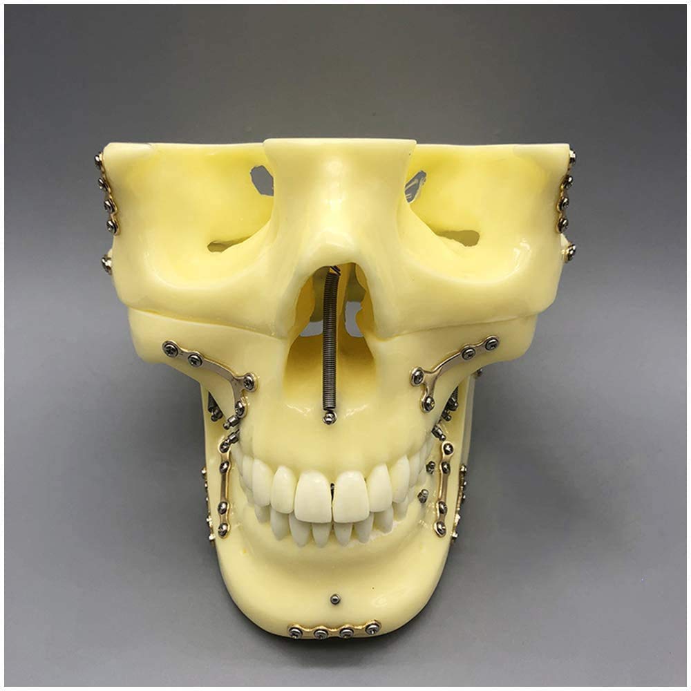 Sjdopulse A Skull Teeth Teaching Model - Teeth Teaching Model - Fracture Fixation Model Mouth Dental Implant Model - Dult Standard Head Oral Cavity Medical Teaching Model - Study Display (A)