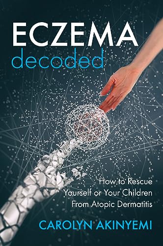 Eczema Decoded: How to Rescue Yourself or Your Children from Atopic Dermatitis (English Edition)
