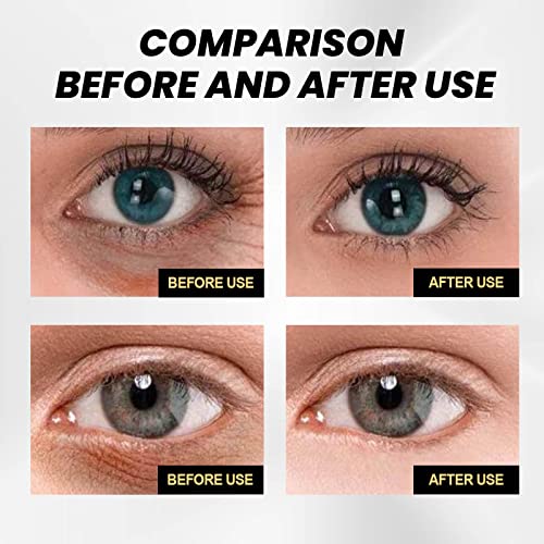 Temporary Firming Eye Cream, Instant Eye Tightening to Removal Under-Eye Bags, Dark Circles & Puffiness, Fine Lines, Deep Wrinkles, Firm and Smooth That Delicate Skin Under Your Eyes, 0.5 oz - Image 6