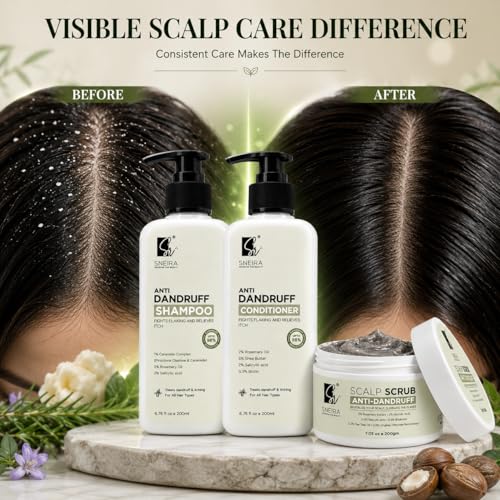 Image of Ultimate Anti Dandruff Kit | Scalp Scrub + Shampoo + Conditioner Combo | 2% Salicylic Acid, Rosemary Oil, Shea Butter & Biotin | Helps Remove Flakes, Cleanse Scalp & Nourish Hair | 600ml