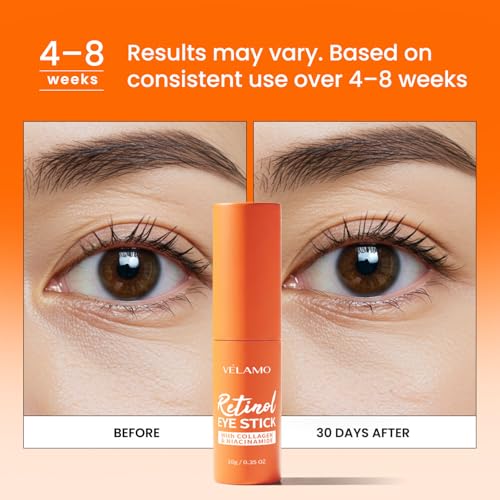 VELAMO ADVANCED Retinol Eye Stick: Plumping & Smoothing Under Eye Balm for Dark Circles, Puffiness & Wrinkles - Made in Korea, Upgraded Formula with Collagen, Niacinamide & Peptides, 0.35 OZ/10g
