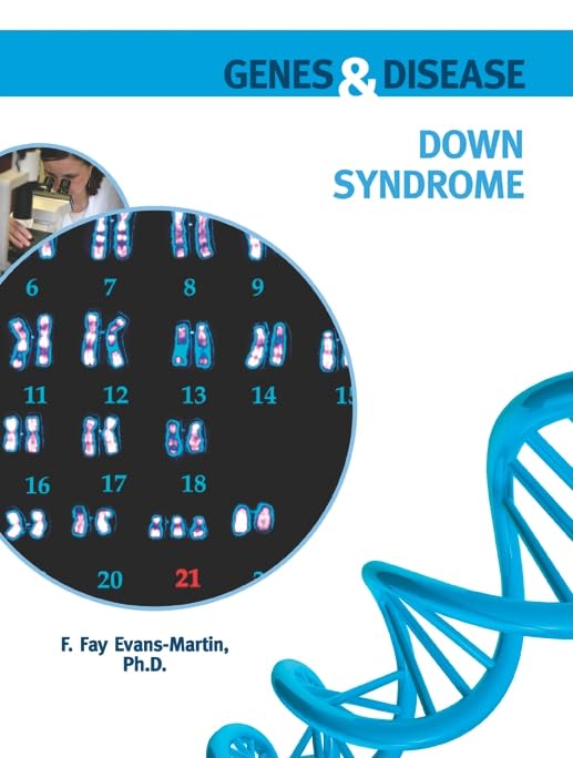 Buy Down Syndrome (Genes and Disease) — BookShops.in