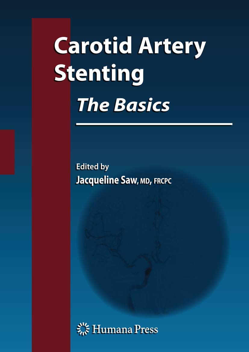 Practical Carotid Artery Stenting [ハードカバー] Double Filtration During Carotid Artery Stenting Using a