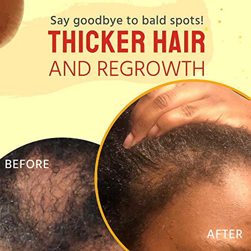 Hair-Oil-Hair-Growth-Oil-100-Natural-Product-for-Hair-Growth-Hair-Growth-Oil-for-Kids-Teens-and-Adults-8-Oz