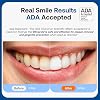 Bitvae Ultrasonic Electric Toothbrush for Adults and Kids, ADA Accepted Travel Toothbrush with Rechargeable 60-Day Battery Life, 5 Modes, 8 Heads, Case, Holder, Frost White