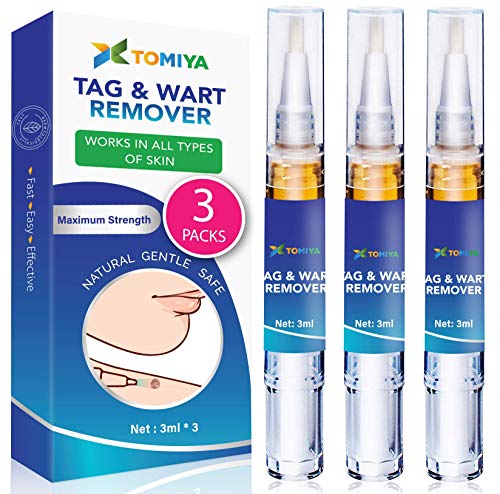 Tomiya Skin Tag Remover - Wart Remover - Quickly Remove Common And Plantar