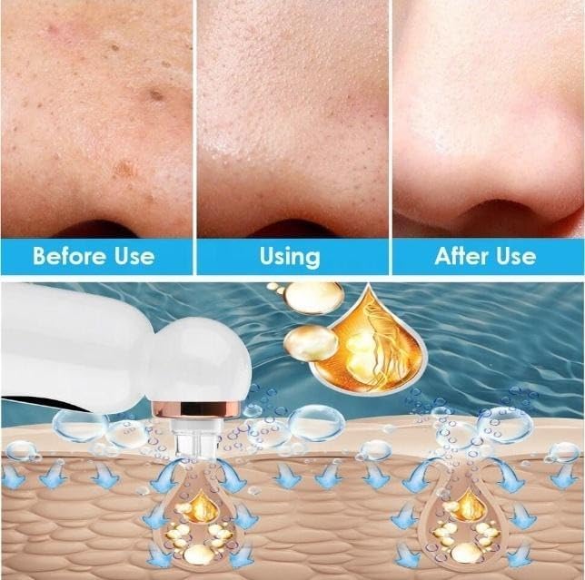 Before and after images of skin showing reduced blackheads and smoother texture after using the device. Below, an illustration depicts the device's action of removing impurities and nourishing the skin.