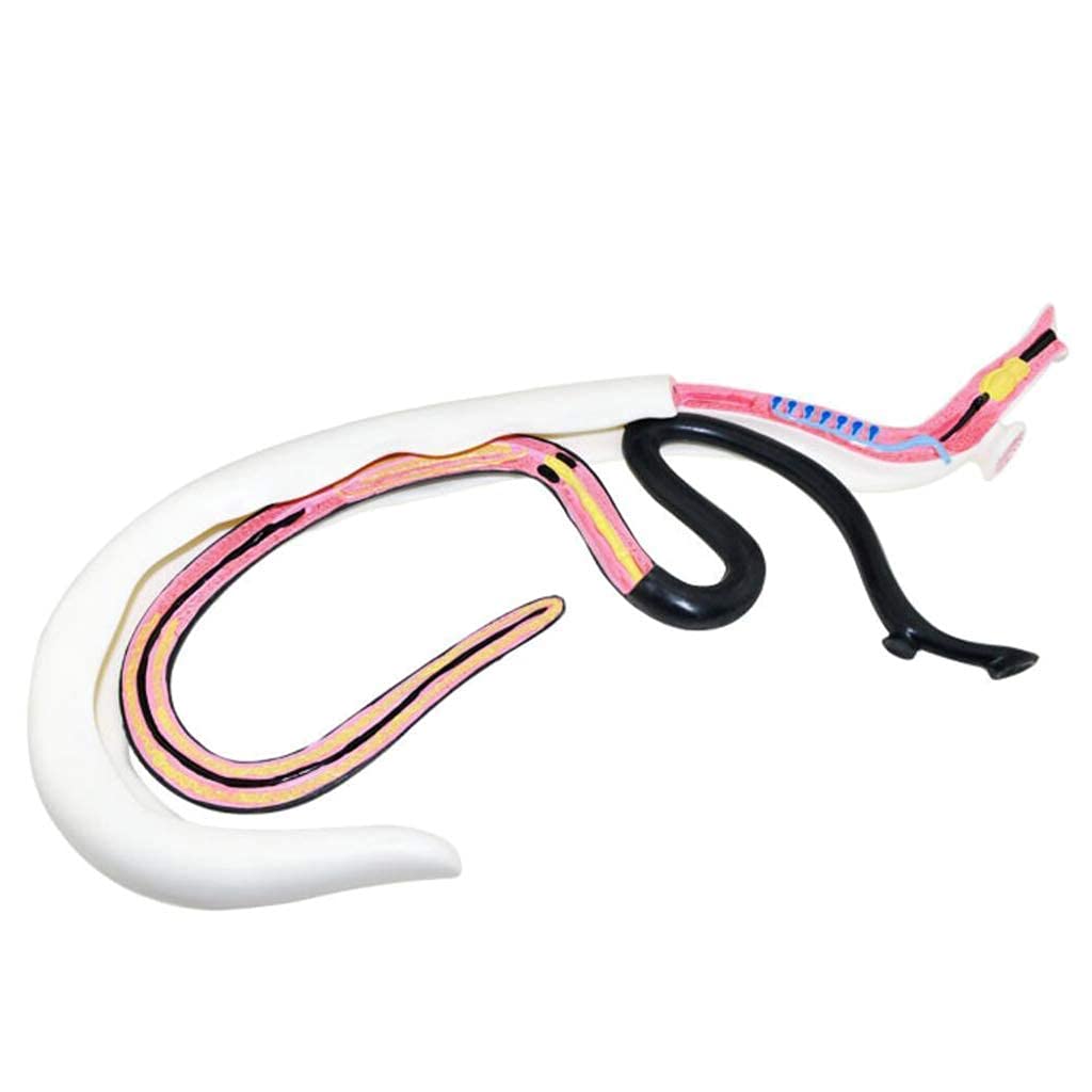 ERNZI Modello di Schistosomiasi, Modello di Anatomia delle Risorse di Apprendimento Biologico, Materiale in PVC Modello di Animale Speciale per La Formazione Medica