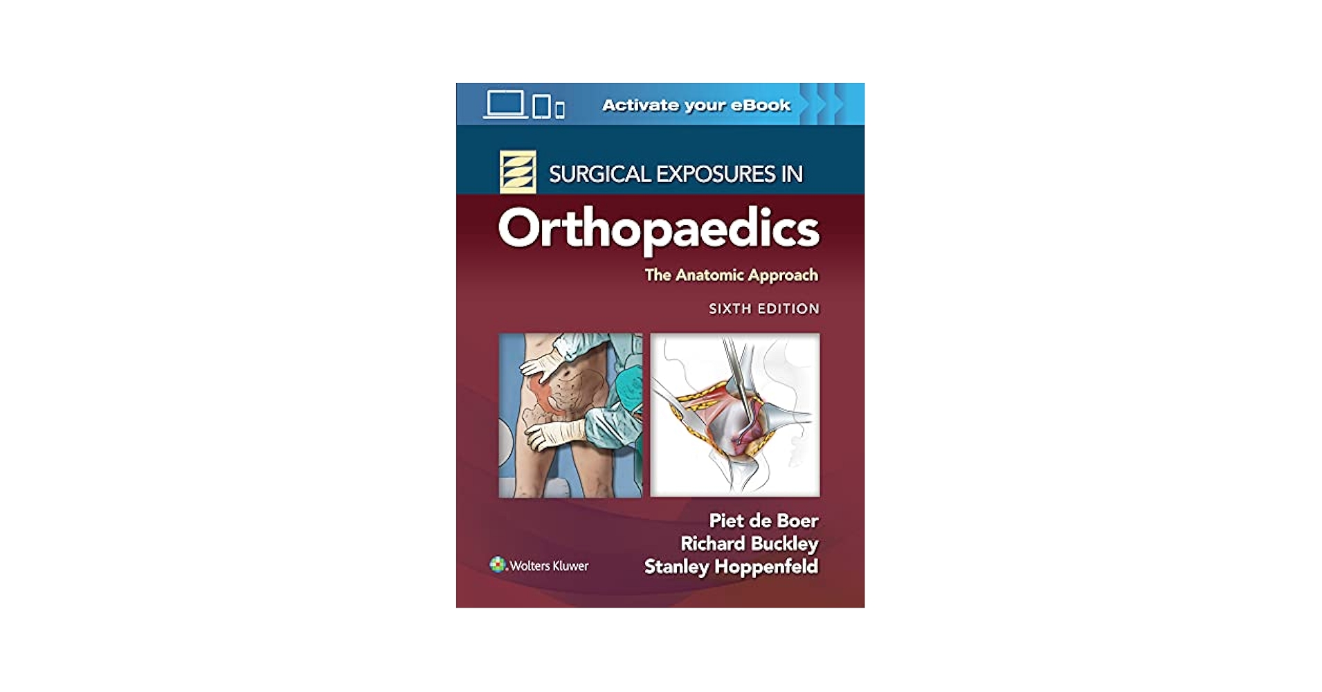 Surgical Exposures in Orthopaedics: The Anatomic Approach [ハードカバー] Hoppenfeld MD， Stanley、 de Boer MD， Dr. Piet; Buckley MD， Dr. Richard Surgical Exposures in Orthopaedics: The Anatomic Approach by