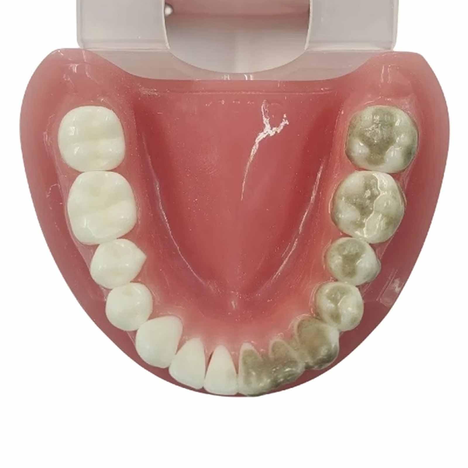 Model Zębów, Model Ekspozycyjny Z Nicią Dentystyczną, Do Nauki, Dla Dentystów, Studentów Stomatologii, Czysty Eksponat (Skóra 8 Cm),Flesh-8cm