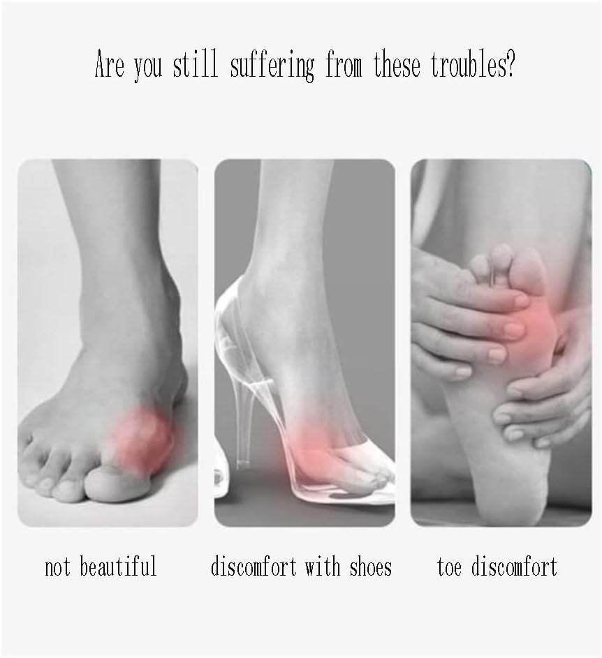 DEAVER Bunion Corrector for Overlapping Toes, Big Toe Straightener,Bunion Splint Support Protectors Sleeve,Pain Relief Sleeves for Hallux Valgus Correction