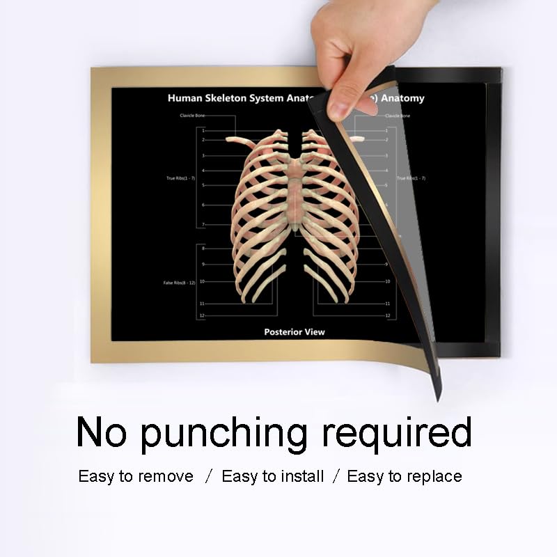 Image of Taanfu Body Educational Learning Anatomy Posters ，Skeleton System Art Intestinal Skeleton Anatomy Art Poster Digestive System Organs Illustration Small Intestine Physiology Anatomy Wall Art Villi