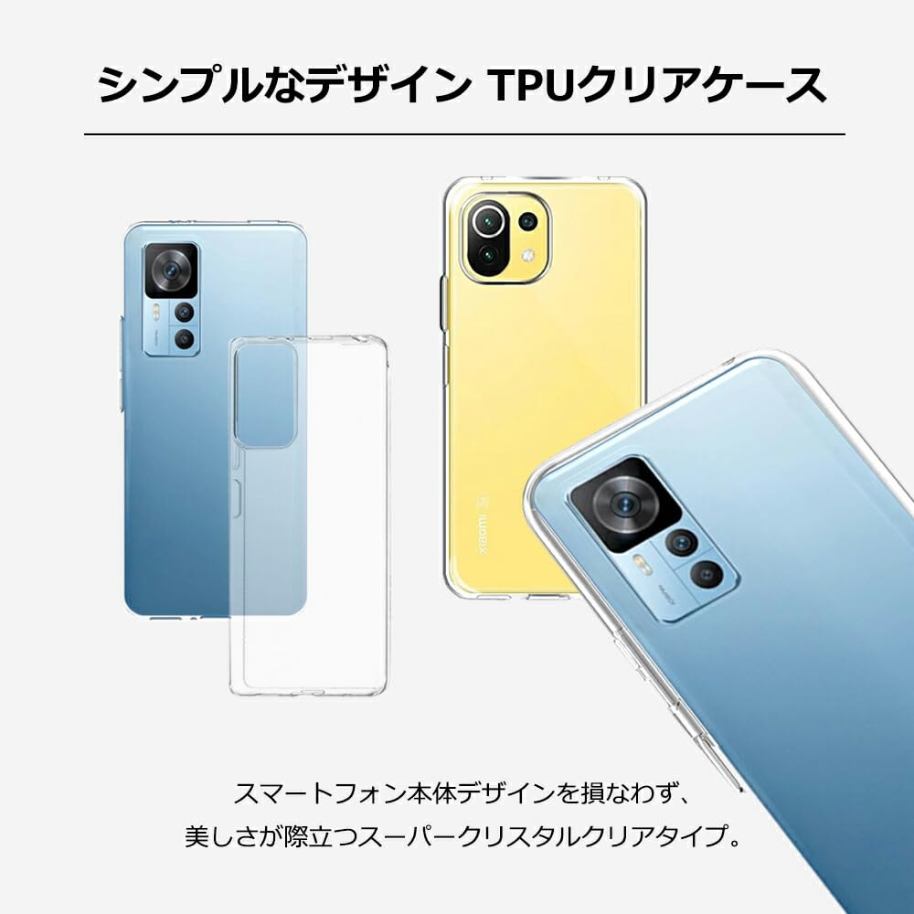 Amazon.co.jp: UOWORLD | Xiaomi Redmi Note 10T / 10JE (XIG02