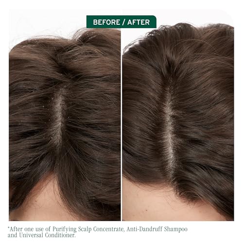 Image of Biolage ScalpSync Concentrate -Scalp Exfoliating & Purifying Treatment, Clarifies Build-Up & Balances Scalp for upto 72hrs-With Fermented Tea Blend & Glycolic Acid, 200ml (Pack of 2)