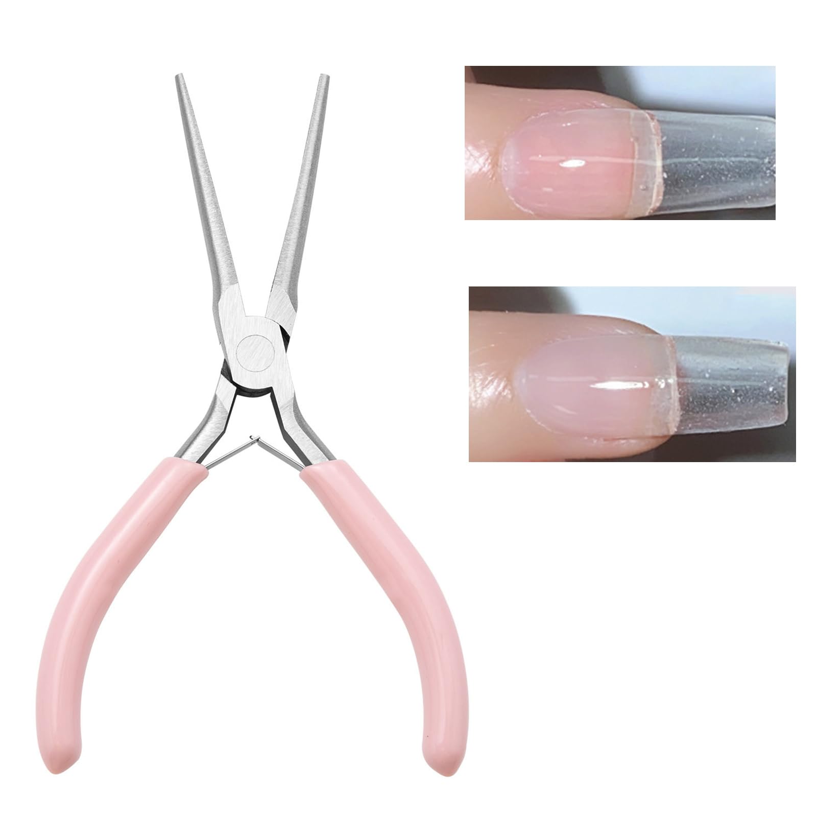 Ingrown Toenail Correction and Removal Kit – Ingrown Toenail Corrector Tool for Ingrown Toenail Pain Relief and Curve Correction at Home with Nickel Titanium Alloy