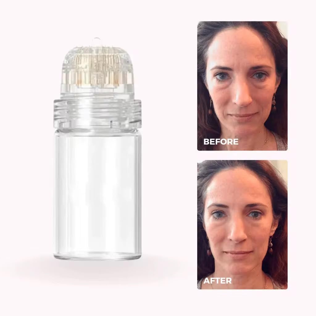 Serum Beauty Micro Infusion System for Face, Lips, Infusion Device image 2