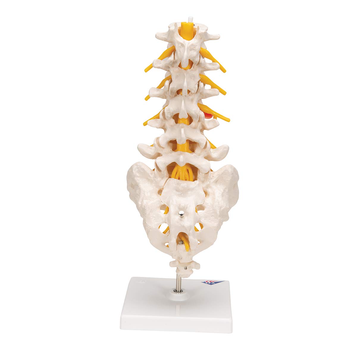 3B Scientific A76/5 Bel Omurga Sütunu, Dorso-Lateral Prolapsed Intervertebral Disk, 34 cm Yükseklik
