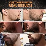 Beard Growth Oil - 1Fl Oz - Growing Serum That Softens & Strengthens Beards and Mustaches - Facial Hair Treatment Treatment Infused with Biotin Capilia Longa Niacinamide and 100% Natural Ingredients - Image 2