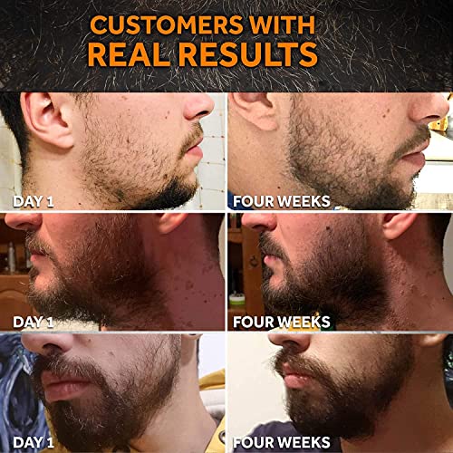 Beard Growth Oil - 1Fl Oz - Growing Serum That Softens & Strengthens Beards and Mustaches - Facial Hair Treatment Treatment Infused with Biotin Capilia Longa Niacinamide and 100% Natural Ingredients - Image 3