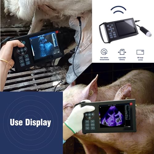 Generic RS-M10 Portable Ultrasound Machine thumb #6