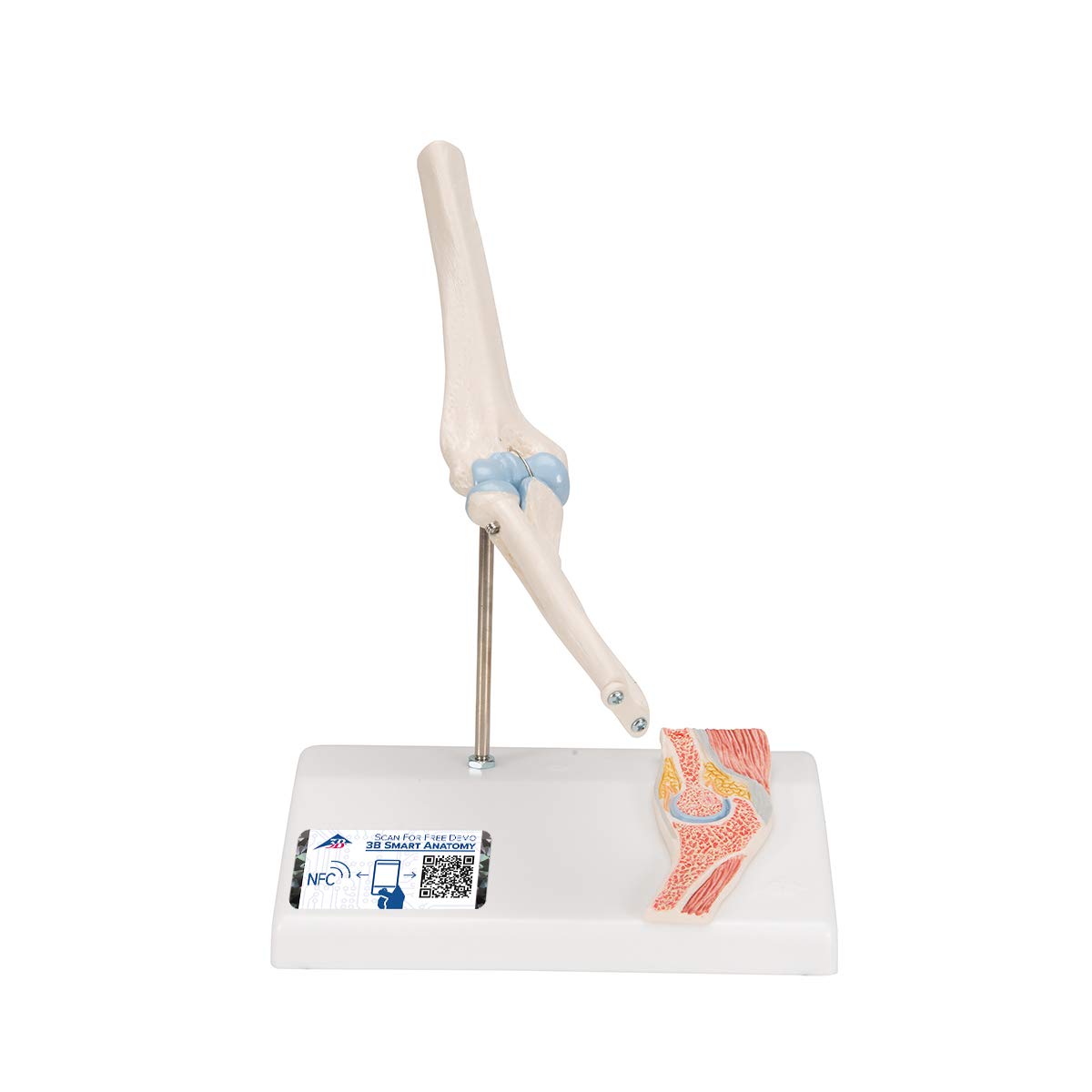 3B Scientific A87/1 Mini staw łokciowy z przekrojem poprzecznym darmowe oprogramowanie anatomiczne - 3B Smart Anatomy