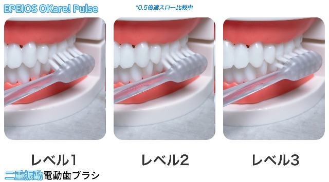 Amazon.co.jp: エペイオス(Epeios) 電動歯ブラシ 二重振動電動歯ブラシ